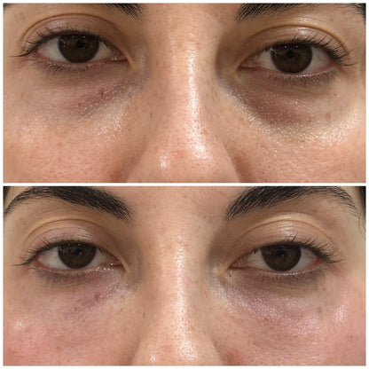 Okira Crema Mágica Anti Ojeras Peptidos 5D