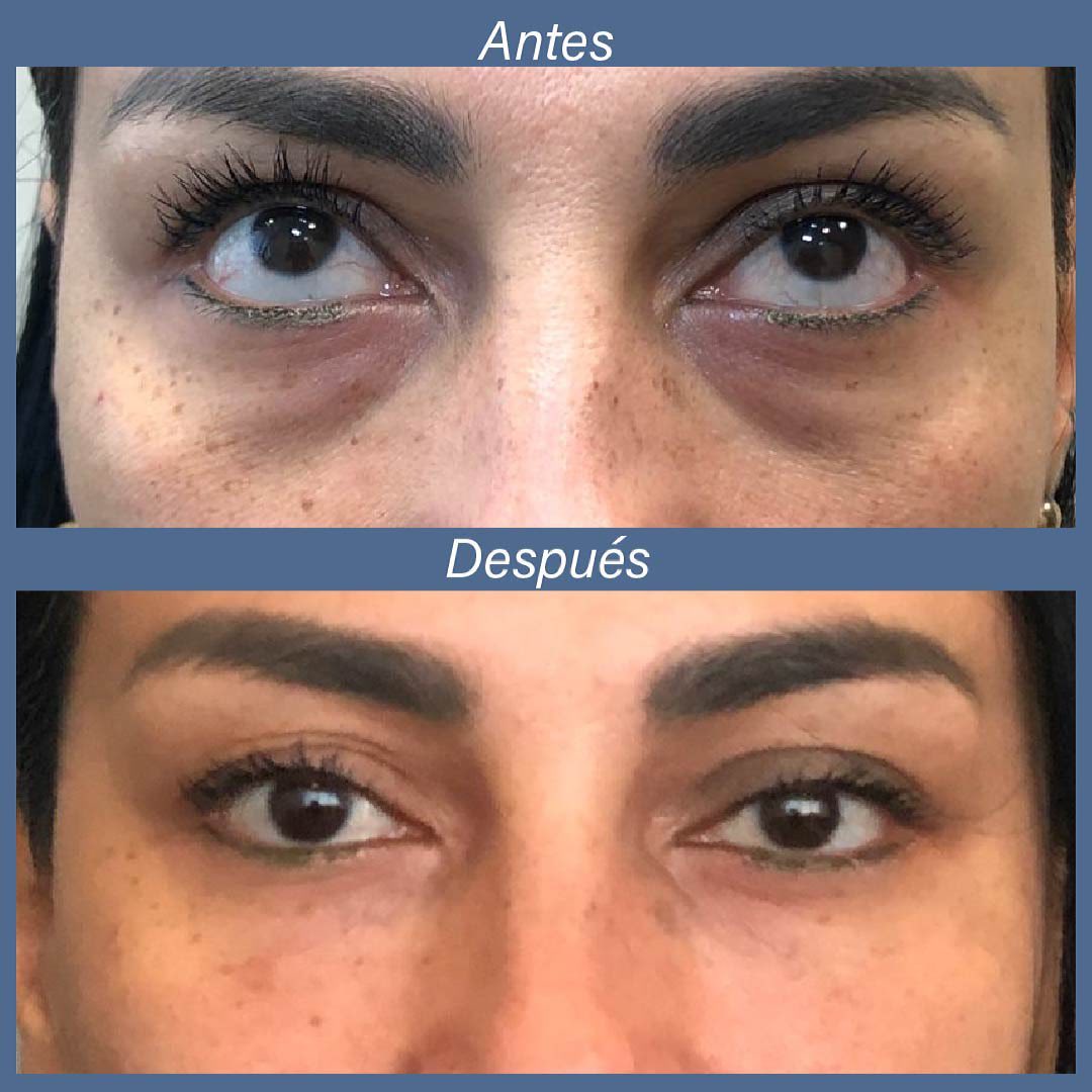 Okira Crema Mágica Anti Ojeras Peptidos 5D