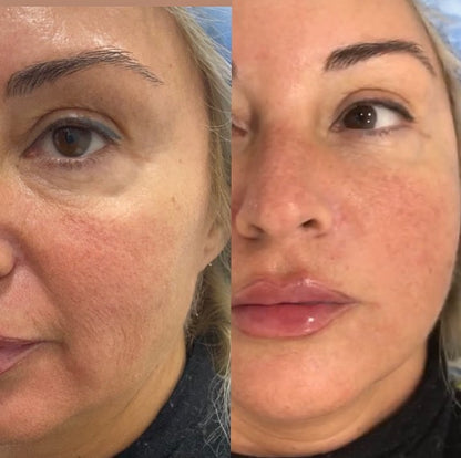 Okira Crema Mágica Anti Ojeras Peptidos 5D