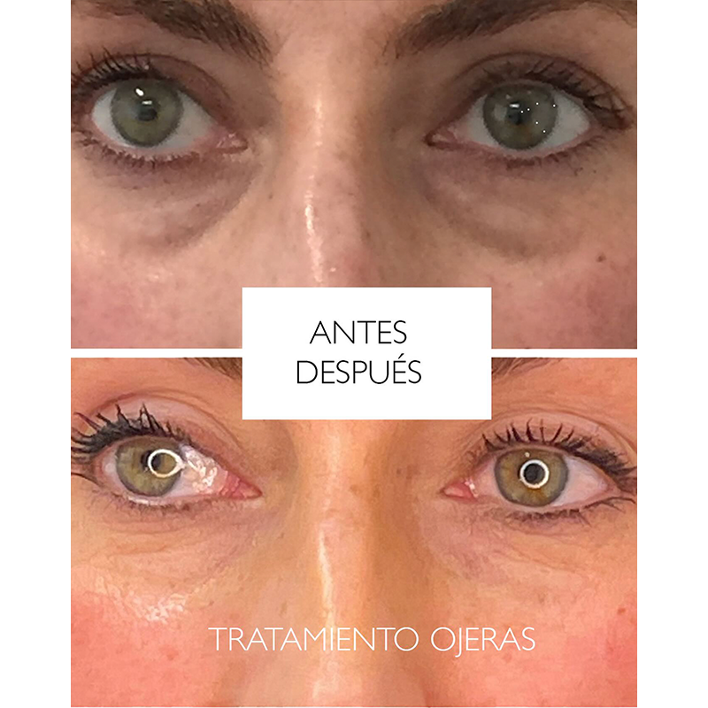 Okira Crema Mágica Anti Ojeras Peptidos 5D