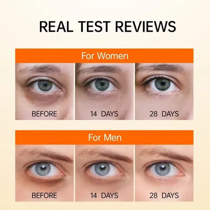 Contorno de Ojos Anti-Ojeras Okira™