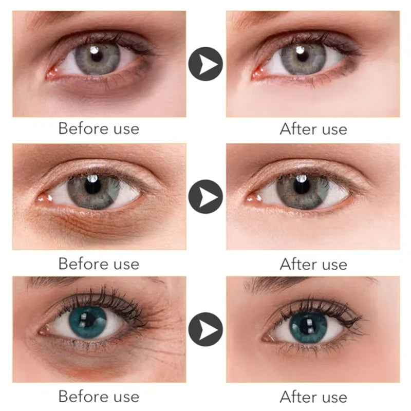 Contorno de Ojos Anti-Ojeras Okira™